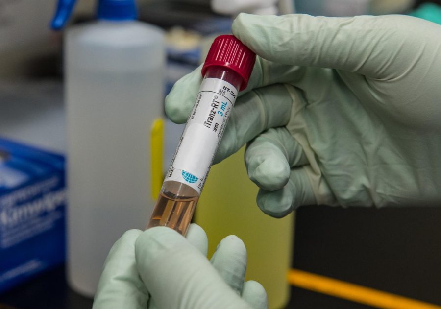 A patients sample containing the coronavirus is tested in a CDC lap. Doctors hope that the availability of the new Omicron booster will help reduce the spread of the virus. 